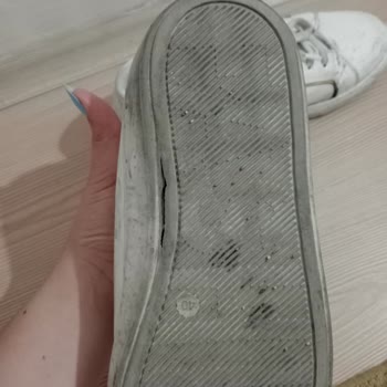 Yeni Aldığım Ayakkabının Altı Açıldı
