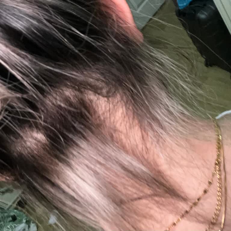 Profesyonellikten Uzak Hizmet: Saçlarım Yandı ve Mağdur Edildim