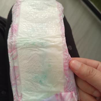 Orkid Platinum Pedlerinde Aşırı Parfüm Kokusu Ve Islaklık Sorunu!