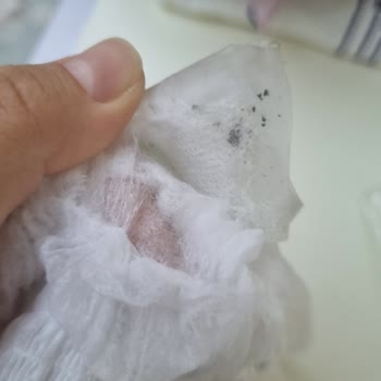 Bebeland Bebek Bezinde Güvenlik Endişesi