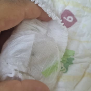 Bebeland Bebek Bezinde Güvenlik Endişesi