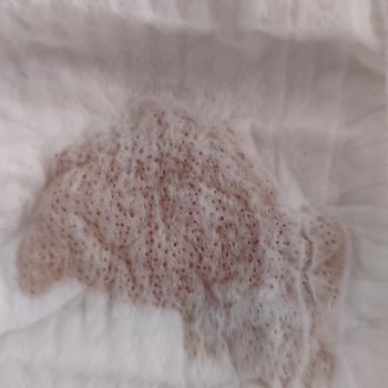 Molfix Bebek Bezinde Yabancı Cisim ve Kalite Sorunu