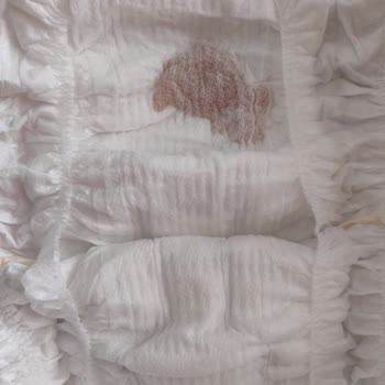 Molfix Bebek Bezinde Yabancı Cisim ve Kalite Sorunu