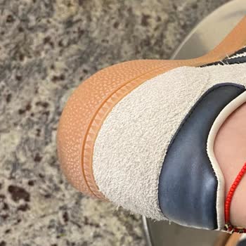 Adidas Ayakkabıda Solma ve Yetersiz Müşteri Hizmeti