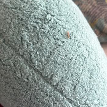 İstikbal Köşe Koltukta Erken Kumaş Sorunu