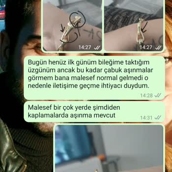 Kaplaması İlk Günden Soyulan Bileklik