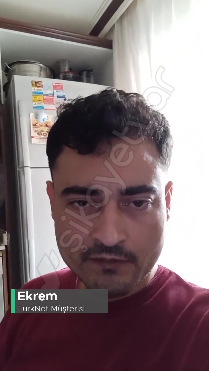 TurkNet Aktivasyon Kurulum Çok Çok Çok Başarısız! videonun kapak resmi