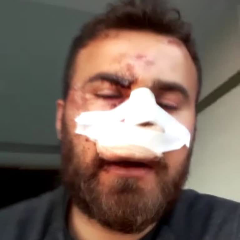 Trafik Kazası Tazminatında Gecikme