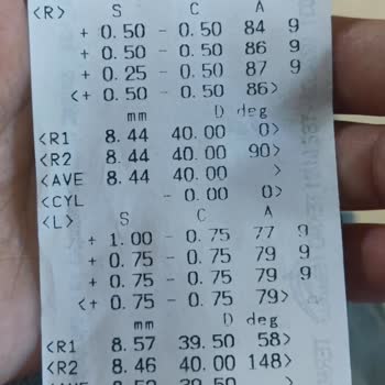 Göz Ameliyatından Sonra Devam Eden Sol Göz Problemi