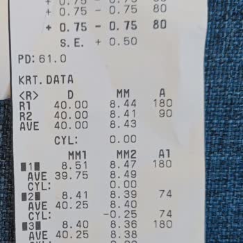 Göz Ameliyatından Sonra Devam Eden Sol Göz Problemi