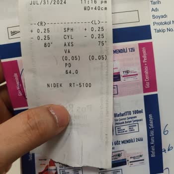 Göz Ameliyatından Sonra Devam Eden Sol Göz Problemi