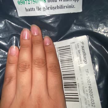 Yanlış Ürün Gönderimi ve Para İadesi Talebi