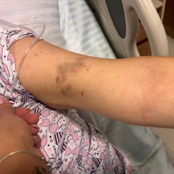 Hayati Tehlike ve İlgisizlik: Ameliyat Kabusu