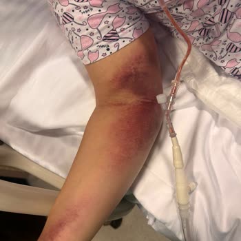 Hayati Tehlike ve İlgisizlik: Ameliyat Kabusu