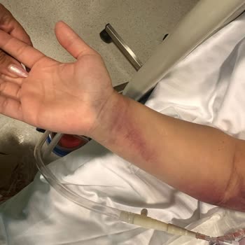 Hayati Tehlike ve İlgisizlik: Ameliyat Kabusu