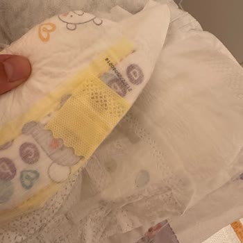 Prima bezlerin yan cırtları kopuyor ve sızdırma yapıyor