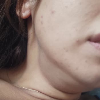 Migros'tan Aldığım Kozmetik Ürünler Yüzümü Mahvetti