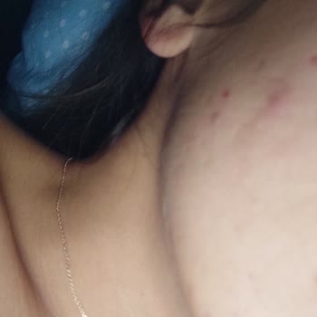 Migros'tan Aldığım Kozmetik Ürünler Yüzümü Mahvetti