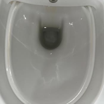 Vitra Gömme Klozetin Temizlik Sorunu ve Hayal Kırıklığı