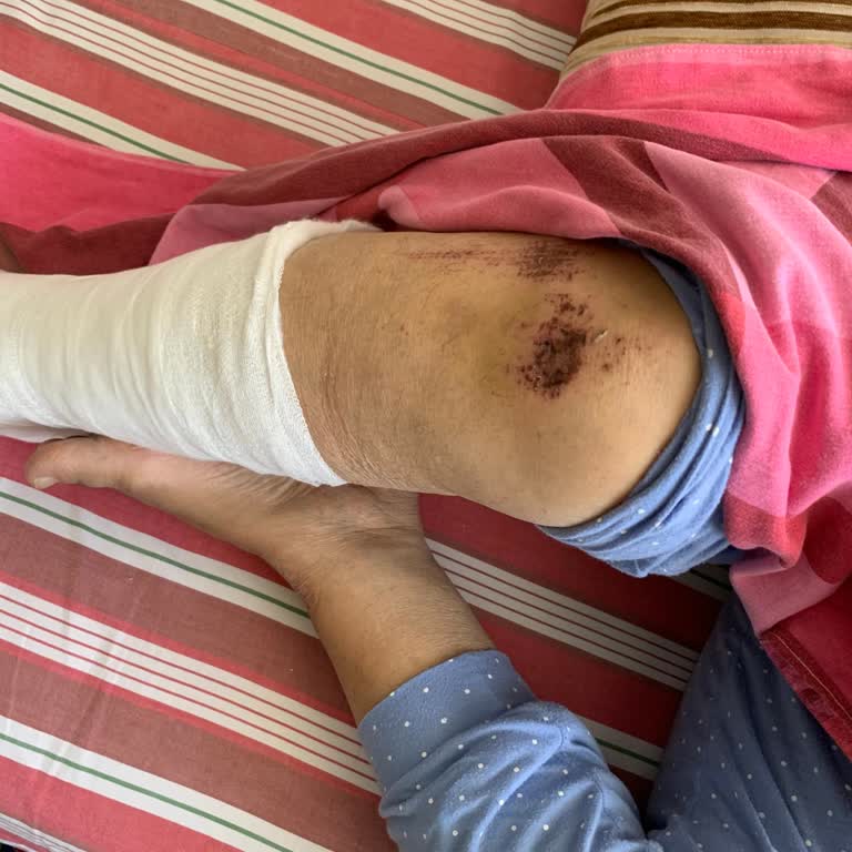 Bingöl Devlet Hastanesi'nde İlgisiz Doktor ve Yanlış Teşhis