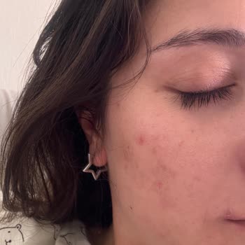 Yves Rocher Hassas Ciltler İçin Uygun Olmayan Ürünler