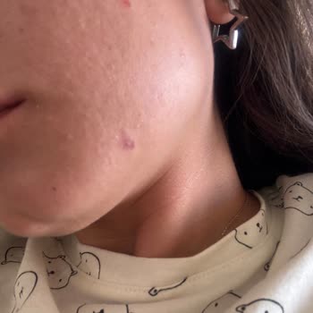 Yves Rocher Hassas Ciltler İçin Uygun Olmayan Ürünler