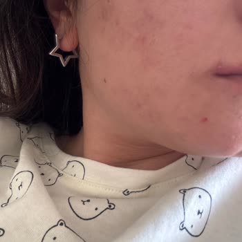 Yves Rocher Hassas Ciltler İçin Uygun Olmayan Ürünler