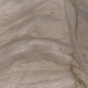 Bebek Bezinde Gizemli Noktalar ve Kaşıntı Sorunu