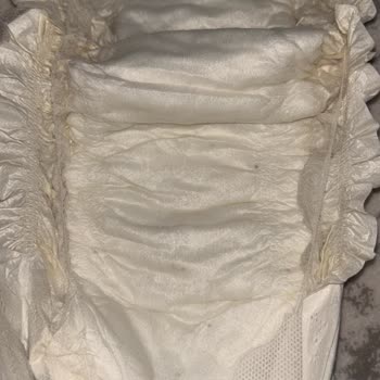 Bebek Bezinde Gizemli Noktalar ve Kaşıntı Sorunu