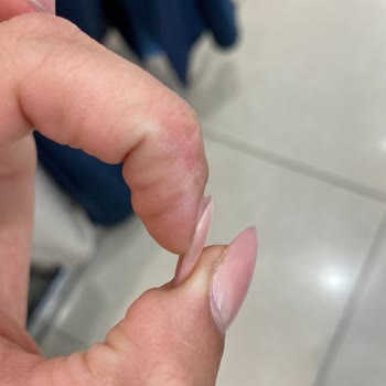 Tırnak Bakımında Hayal Kırıklığı