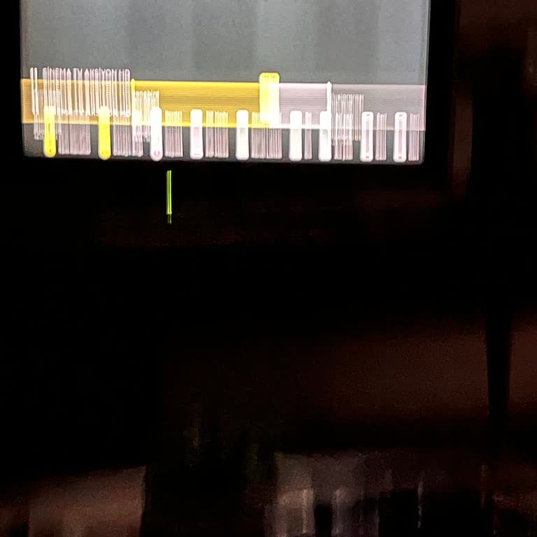 Turkcell TV Hizmet Sorunu ve İletişim Eksikliği