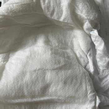 Sleepy Bebek Bezinde Beklenmeyen Cisim!