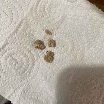 Harras Basmati Pirinçte Gizemli Kahverengi Cisimler Şoku