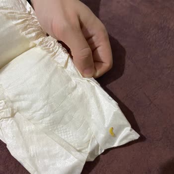 Bebek Bezinde Kurt Şoku!