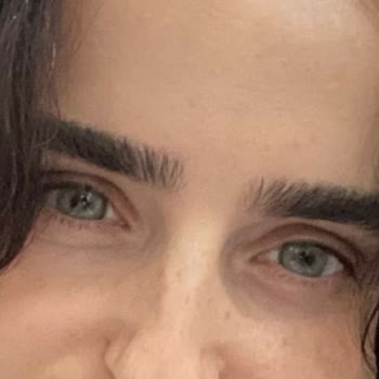 Yanıltıcı Lens Satışı ve Instagram Engeli