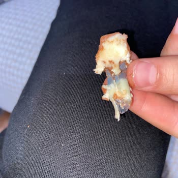 Çikolatanın İçinden Çıkan Plastik Parçası