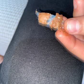 Çikolatanın İçinden Çıkan Plastik Parçası