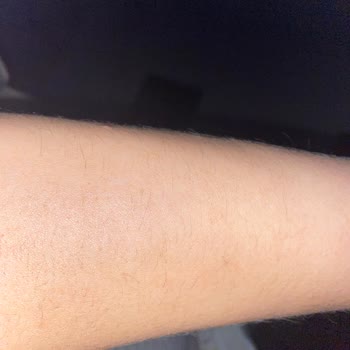 Nez Demir Ankara Şubesi'nde Buz Lazer Hayal Kırıklığı