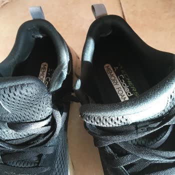 Skechers Ayakkabılarımın Hızla Yırtılması ve Kullanıcı Hatası Yanıtı