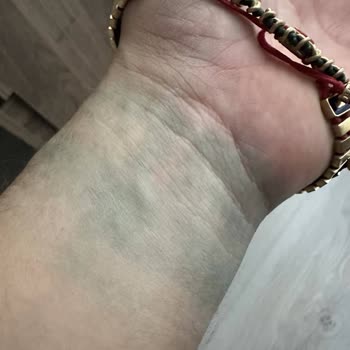 Kalitesiz Materyal ve Yetersiz Tadilat: Yeşil Leke Sorunu