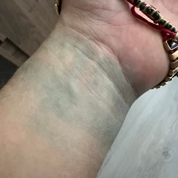 Kalitesiz Materyal ve Yetersiz Tadilat: Yeşil Leke Sorunu