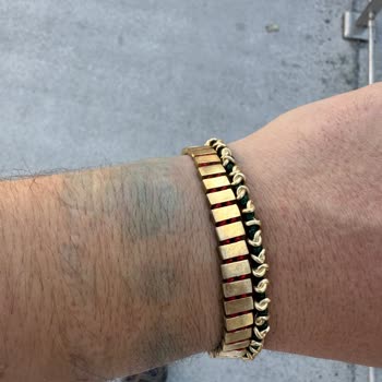 Kalitesiz Materyal ve Yetersiz Tadilat: Yeşil Leke Sorunu