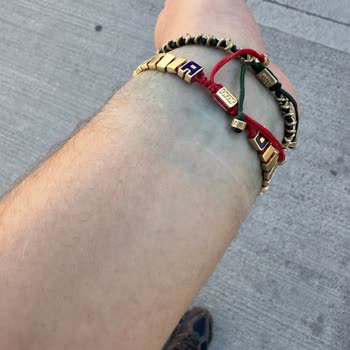 Kalitesiz Materyal ve Yetersiz Tadilat: Yeşil Leke Sorunu