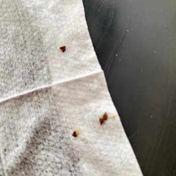 Marketten Alınan Börekten Taş Çıkması Üzerine Sağlık Endişeleri