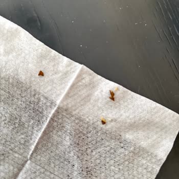 Marketten Alınan Börekten Taş Çıkması Üzerine Sağlık Endişeleri