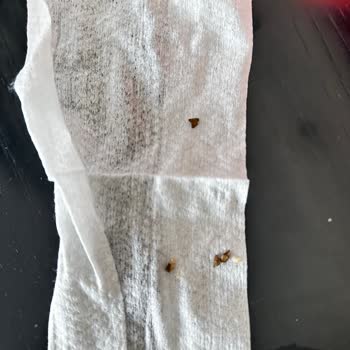 Marketten Alınan Börekten Taş Çıkması Üzerine Sağlık Endişeleri