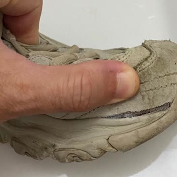 Skechers Ayakkabının Kalitesizliği ve İnceleme Sürecine Tepki
