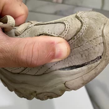 Skechers Ayakkabının Kalitesizliği ve İnceleme Sürecine Tepki