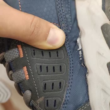Skechers ayakkabımın yan tarafı açıldı, yalanlarla karşılaştım
