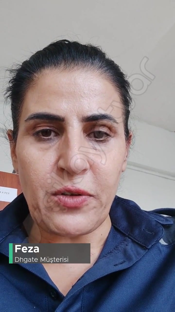 Dhgate Siparişim Olan Kamerayı Göndermediler, Yasal Sürece Başvuracağız! videonun kapak resmi